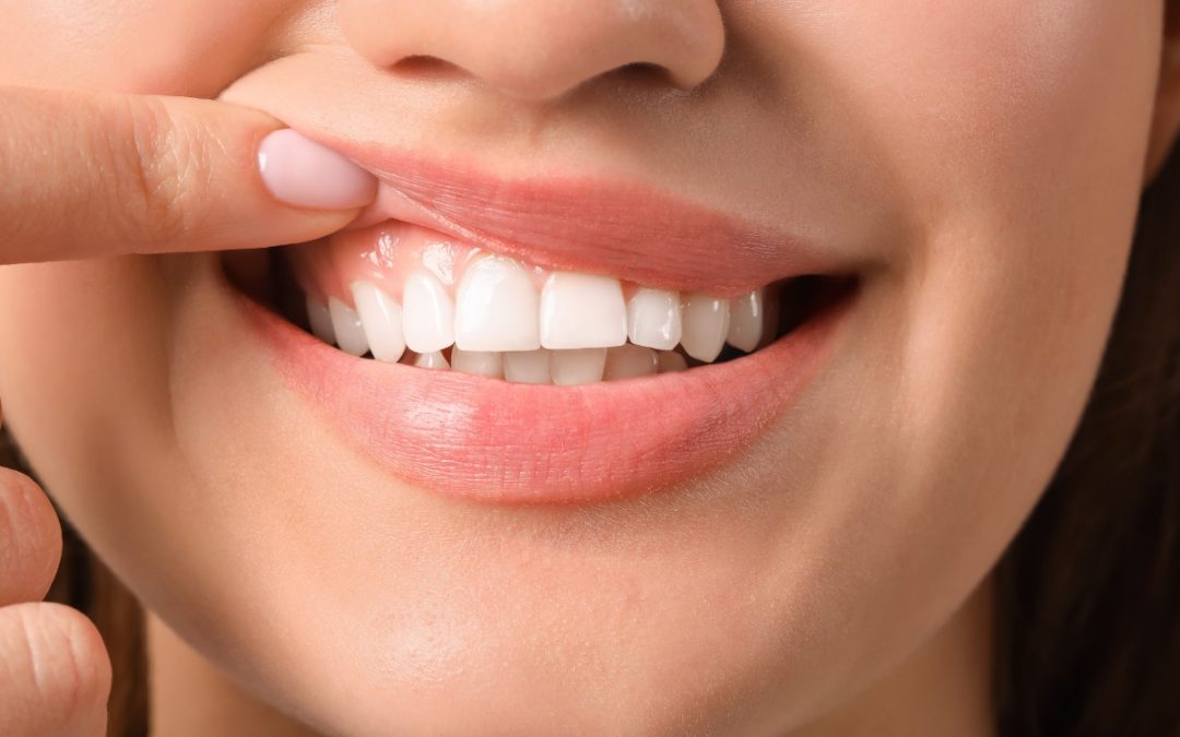 5 Signs Your Gums Need Help